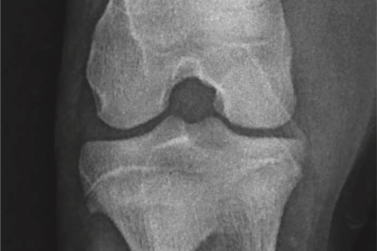 x-ray of joint